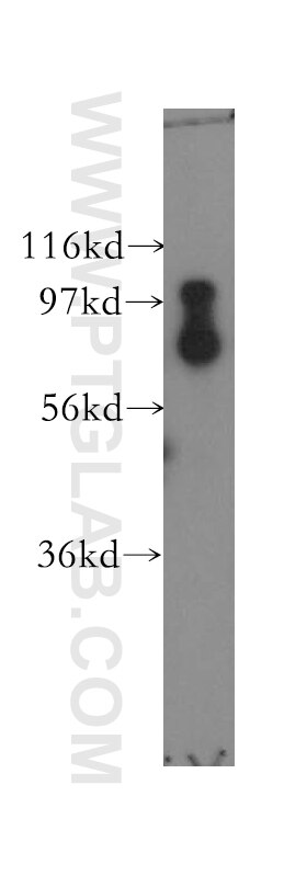 WB analysis of mouse uterus using 12325-1-AP