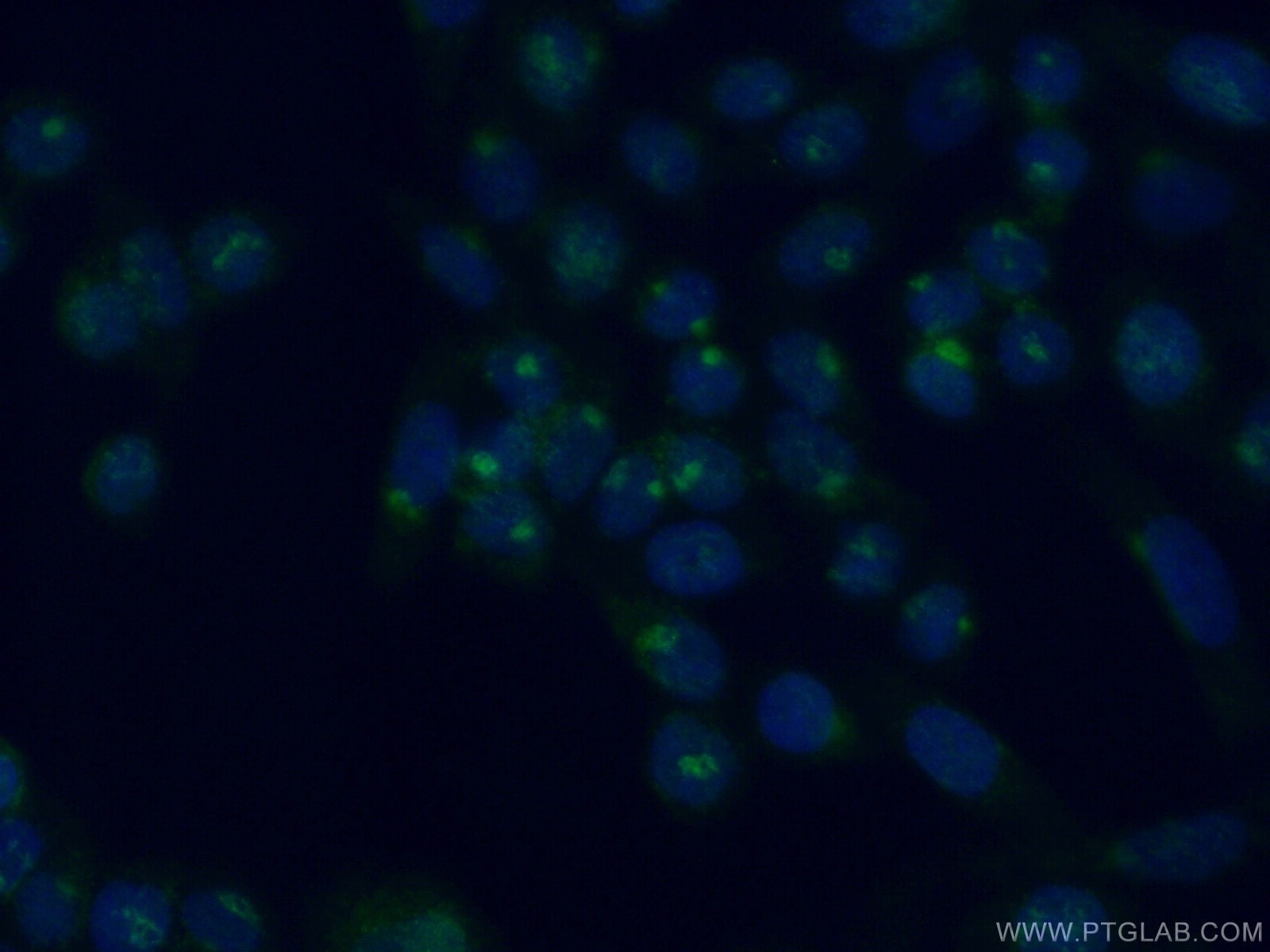 Immunofluorescence (IF) / fluorescent staining of HeLa cells using SCYL3 Polyclonal antibody (11249-1-AP)