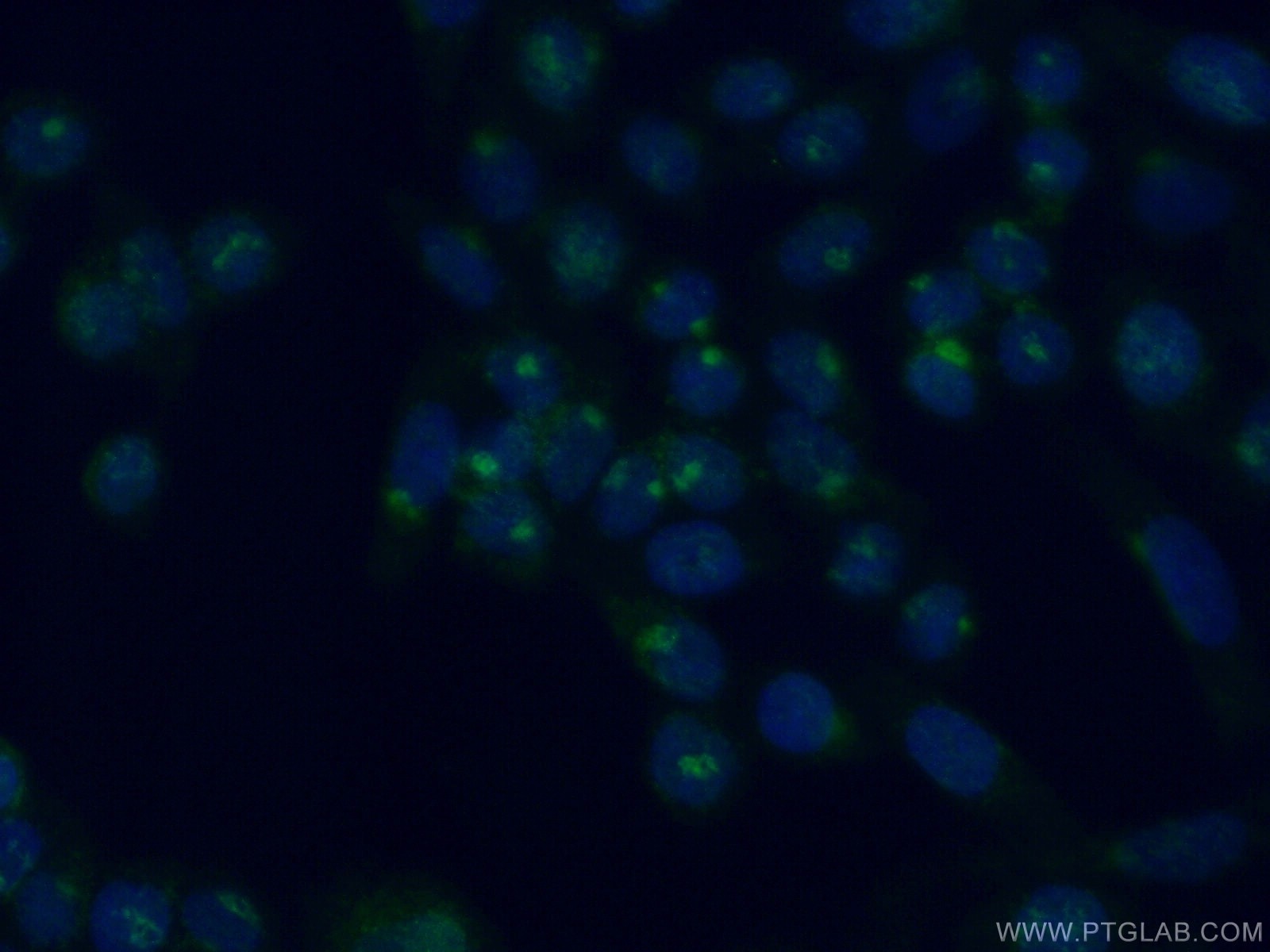 IF Staining of HeLa using 11249-1-AP