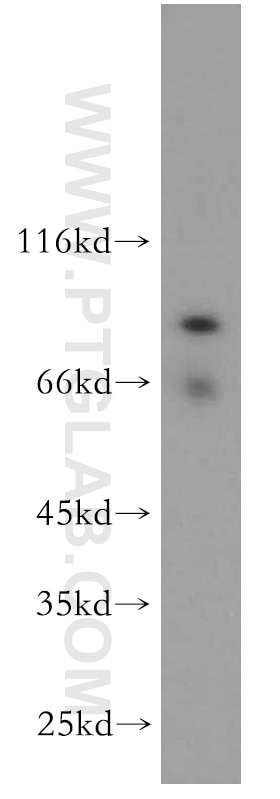 Western Blot (WB) analysis of human brain tissue using SCYL3 Polyclonal antibody (11249-1-AP)