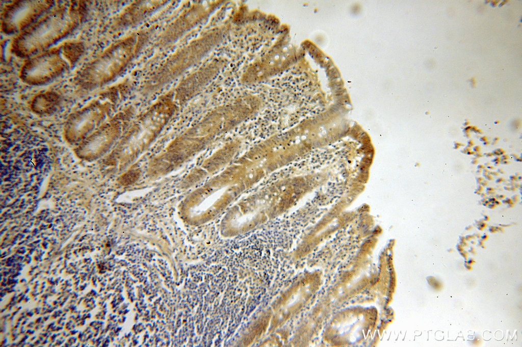 CD138/Syndecan-1