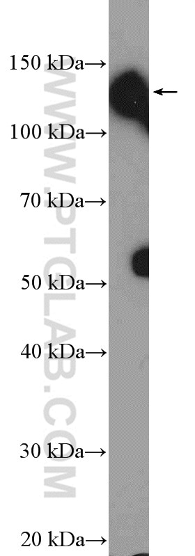 Western Blot (WB) analysis of mouse spleen tissue using CD138/Syndecan-1 Polyclonal antibody (10593-1-AP)
