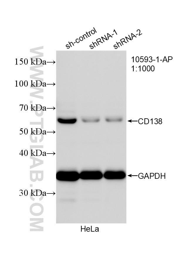 Western Blot (WB) analysis of HeLa cells using CD138/Syndecan-1 Polyclonal antibody (10593-1-AP)