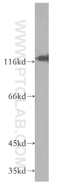 Western Blot (WB) analysis of BxPC-3 cells using CD138/Syndecan-1 Monoclonal antibody (60185-1-Ig)