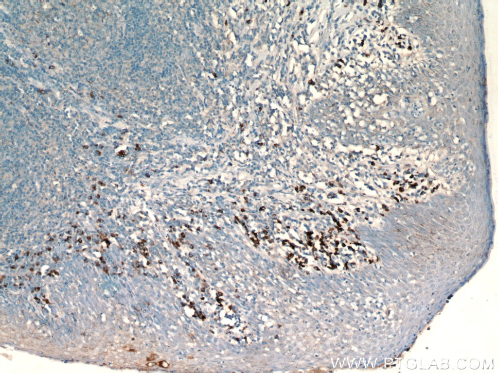 Immunohistochemistry (IHC) staining of human tonsil tissue using CD138/Syndecan-1 Monoclonal antibody (60185-2-Ig)