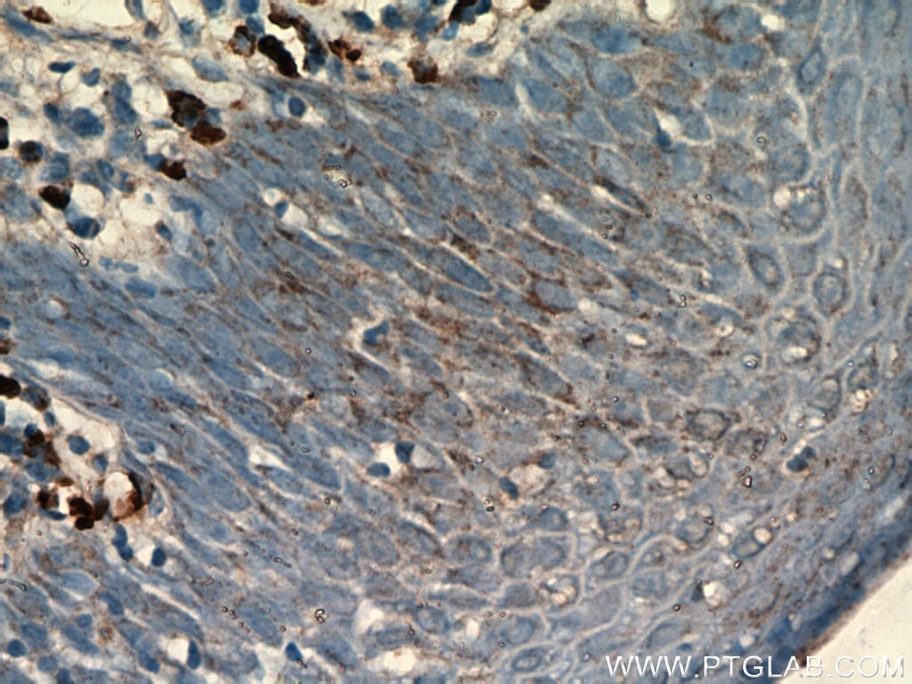 Immunohistochemistry (IHC) staining of human tonsil tissue using CD138/Syndecan-1 Monoclonal antibody (60185-2-Ig)