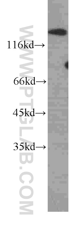 Western Blot (WB) analysis of MCF-7 cells using CD138/Syndecan-1 Monoclonal antibody (60185-2-Ig)