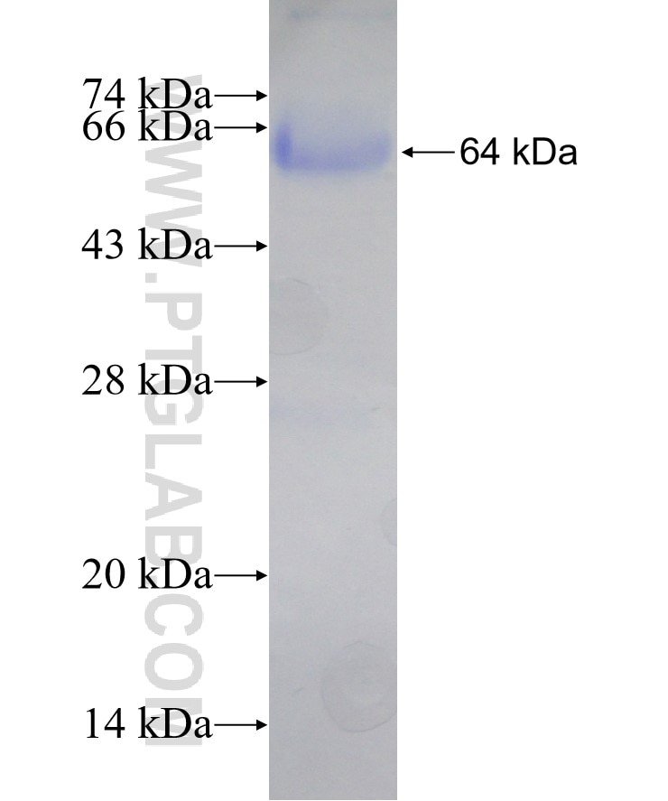 SDC1,CD138 fusion protein Ag17733 SDS-PAGE