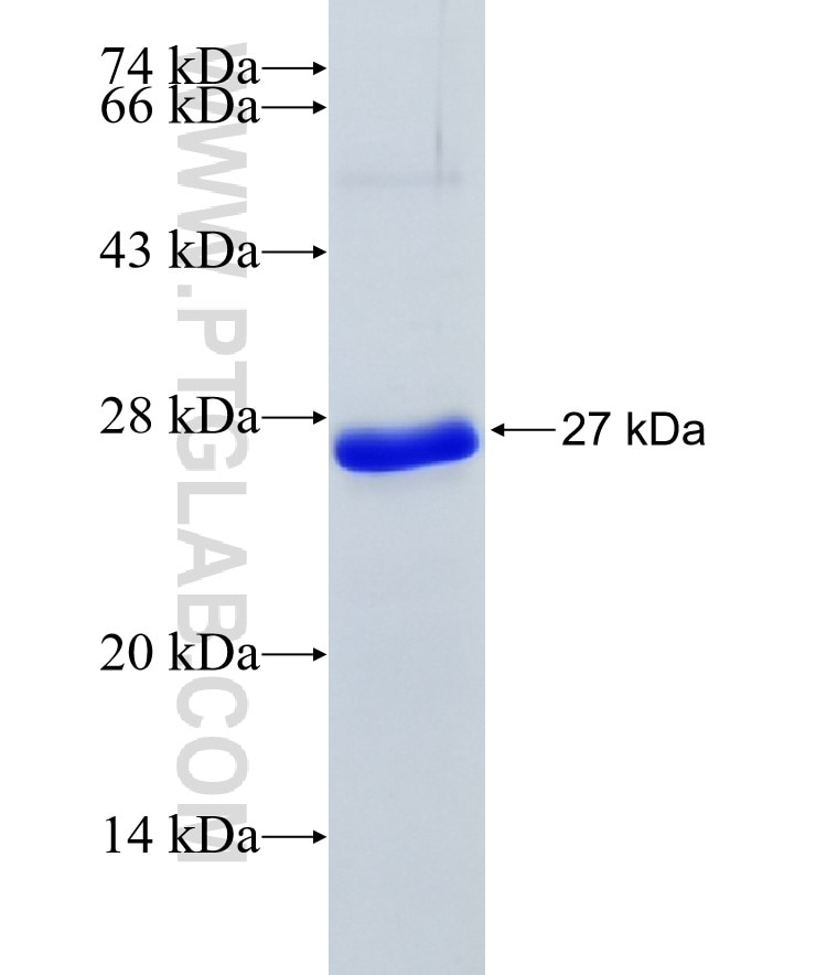 SDC2 fusion protein Ag5739 SDS-PAGE