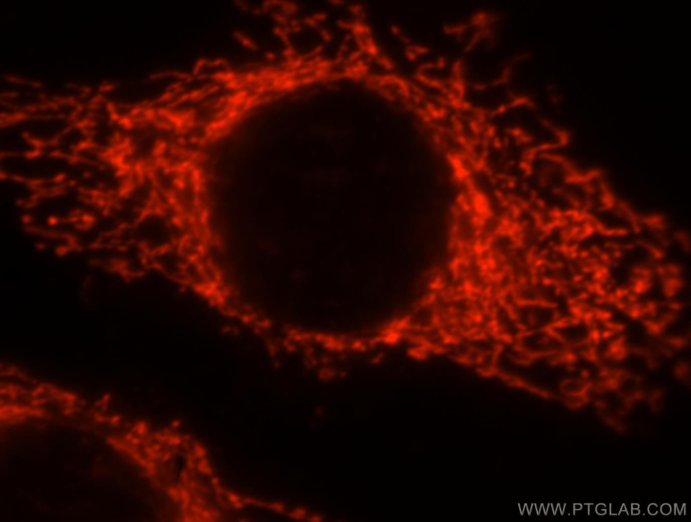 Immunofluorescence (IF) / fluorescent staining of MCF-7 cells using Syndecan-3 Polyclonal antibody (10886-1-AP)