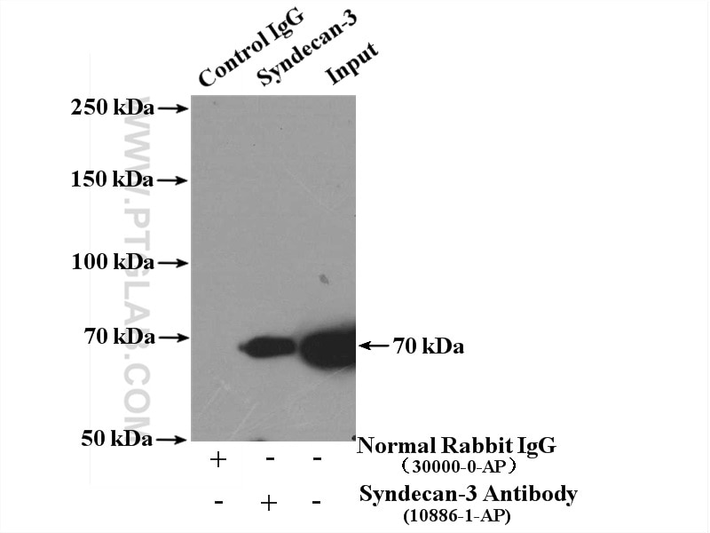 Immunoprecipitation (IP) experiment of A549 cells using Syndecan-3 Polyclonal antibody (10886-1-AP)