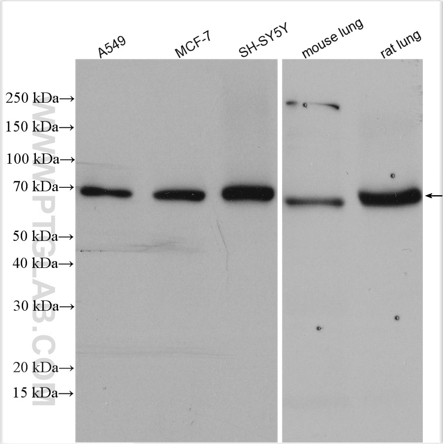 Western Blot (WB) analysis of various lysates using Syndecan-3 Polyclonal antibody (10886-1-AP)