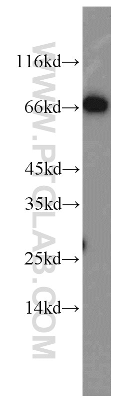 Western Blot (WB) analysis of MCF-7 cells using Syndecan-3 Polyclonal antibody (10886-1-AP)