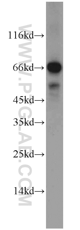 Western Blot (WB) analysis of rat kidney tissue using Syndecan-3 Polyclonal antibody (10886-1-AP)