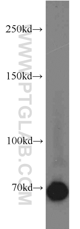 Western Blot (WB) analysis of Jurkat cells using Syndecan-3 Polyclonal antibody (10886-1-AP)