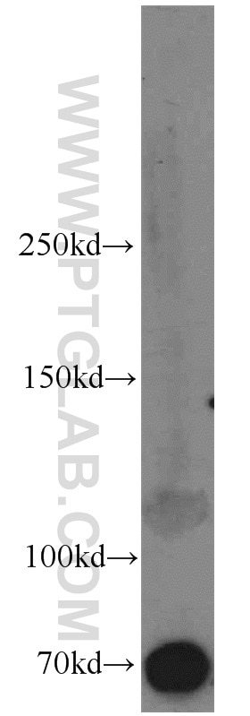 Western Blot (WB) analysis of mouse kidney tissue using Syndecan-3 Polyclonal antibody (10886-1-AP)