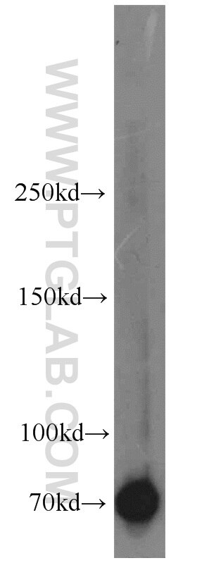 Western Blot (WB) analysis of L02 cells using Syndecan-3 Polyclonal antibody (10886-1-AP)