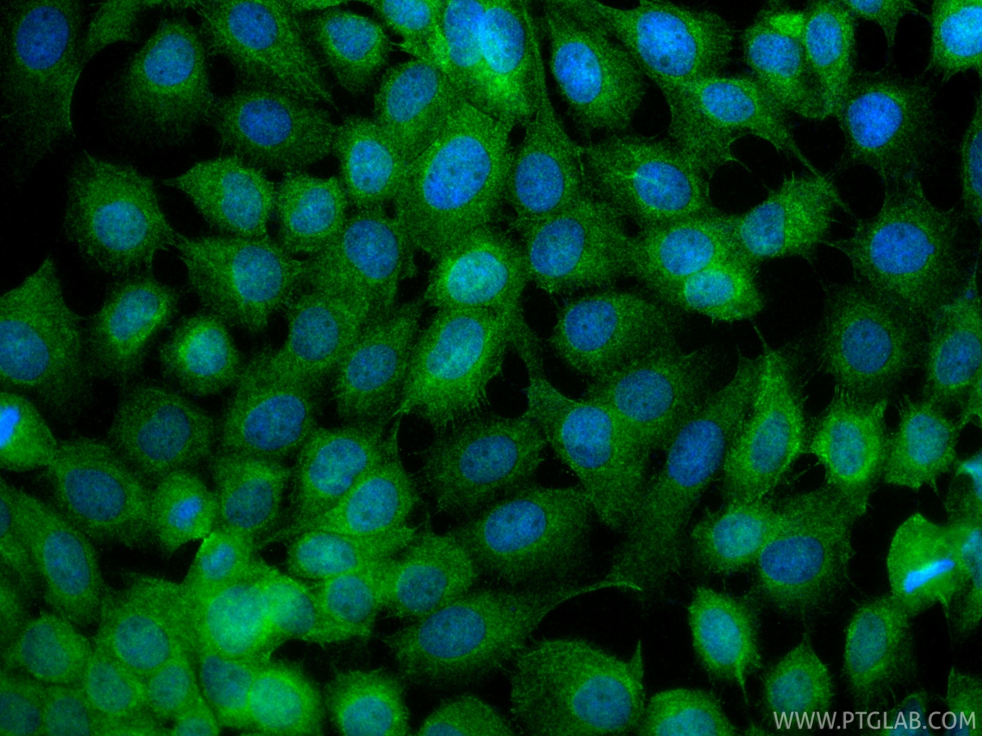Immunofluorescence (IF) / fluorescent staining of A431 cells using SDC4 Polyclonal antibody (11820-1-AP)