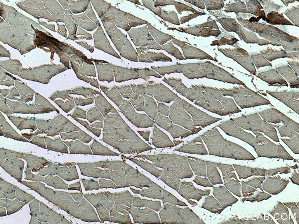 Immunohistochemistry (IHC) staining of mouse skeletal muscle tissue using SDC4 Polyclonal antibody (11820-1-AP)