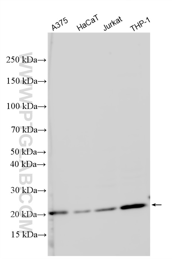 Western Blot (WB) analysis of various lysates using SDC4 Polyclonal antibody (11820-1-AP)