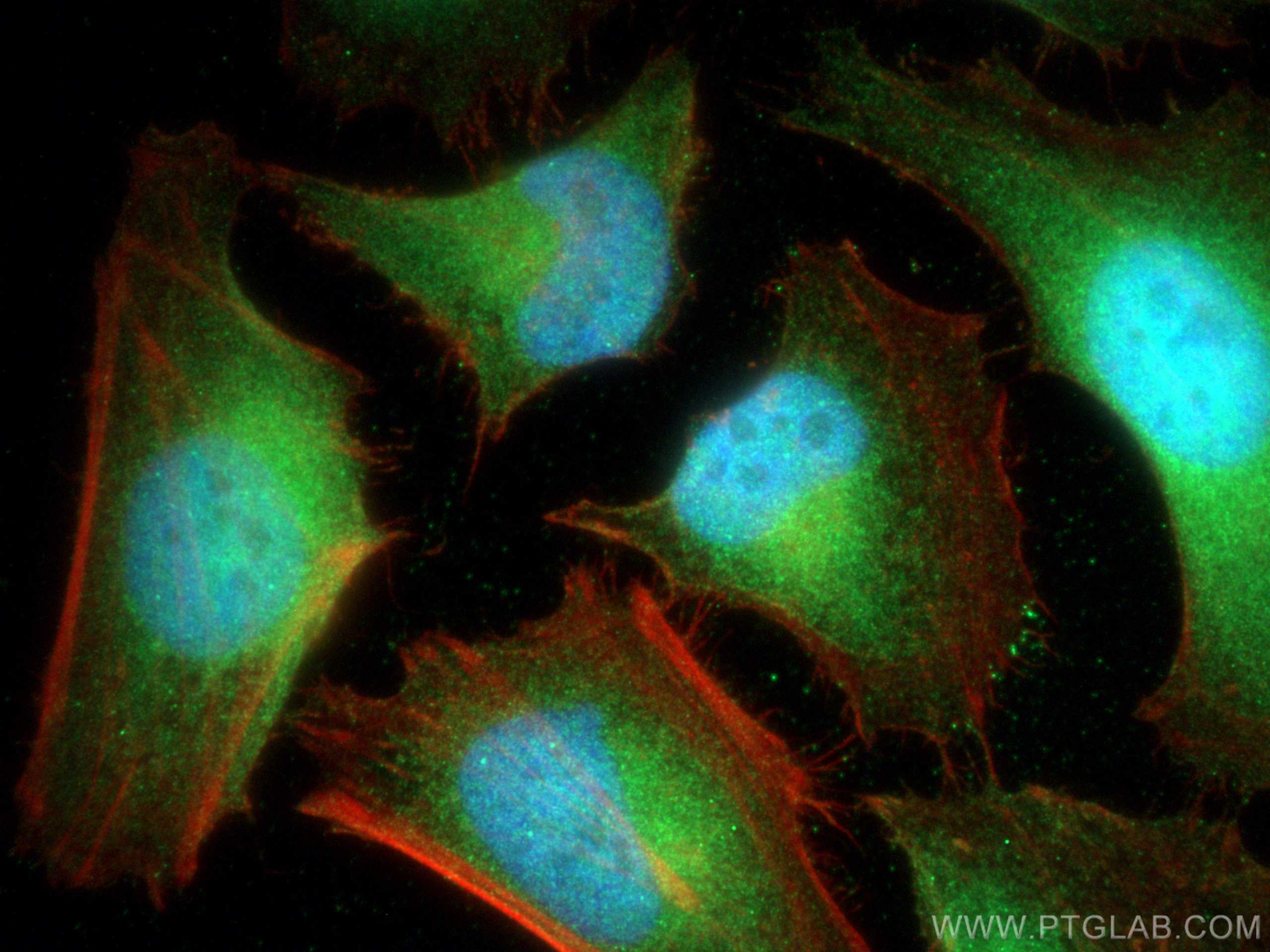 Immunofluorescence (IF) / fluorescent staining of HeLa cells using Syntenin-1 Polyclonal antibody (22399-1-AP)