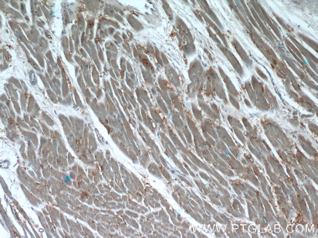 Immunohistochemistry (IHC) staining of human heart tissue using Syntenin-1 Polyclonal antibody (22399-1-AP)