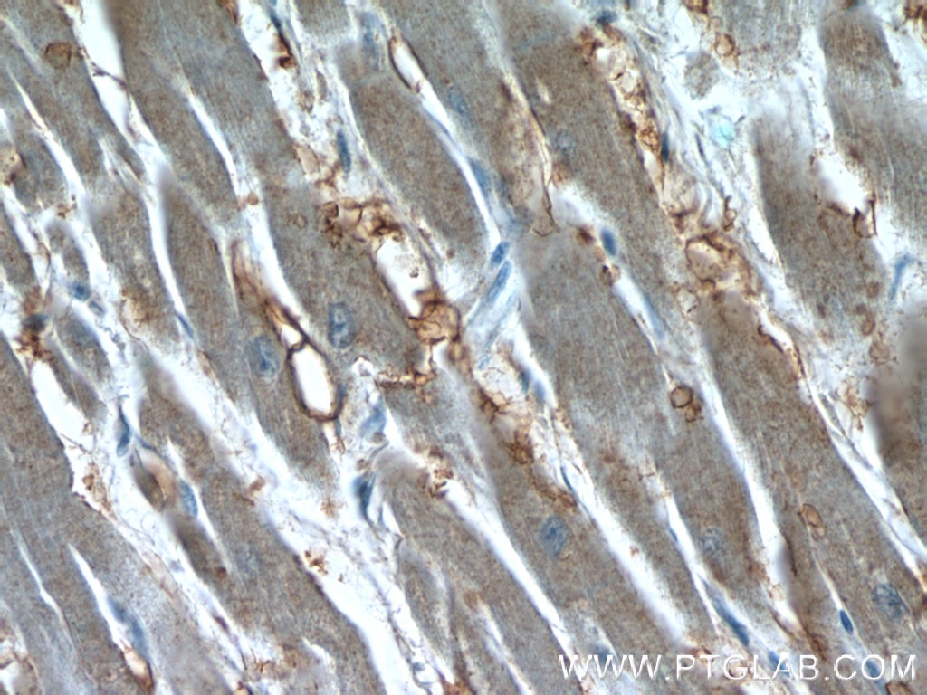 IHC staining of human heart using 22399-1-AP