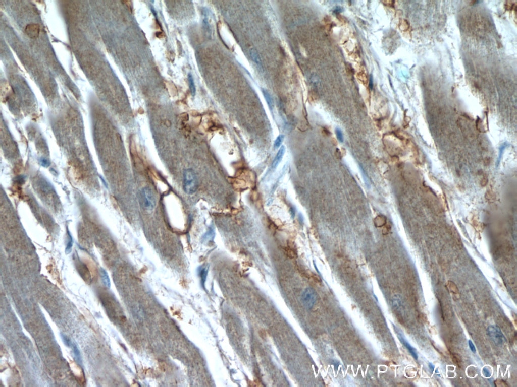 Immunohistochemistry (IHC) staining of human heart tissue using Syntenin-1 Polyclonal antibody (22399-1-AP)