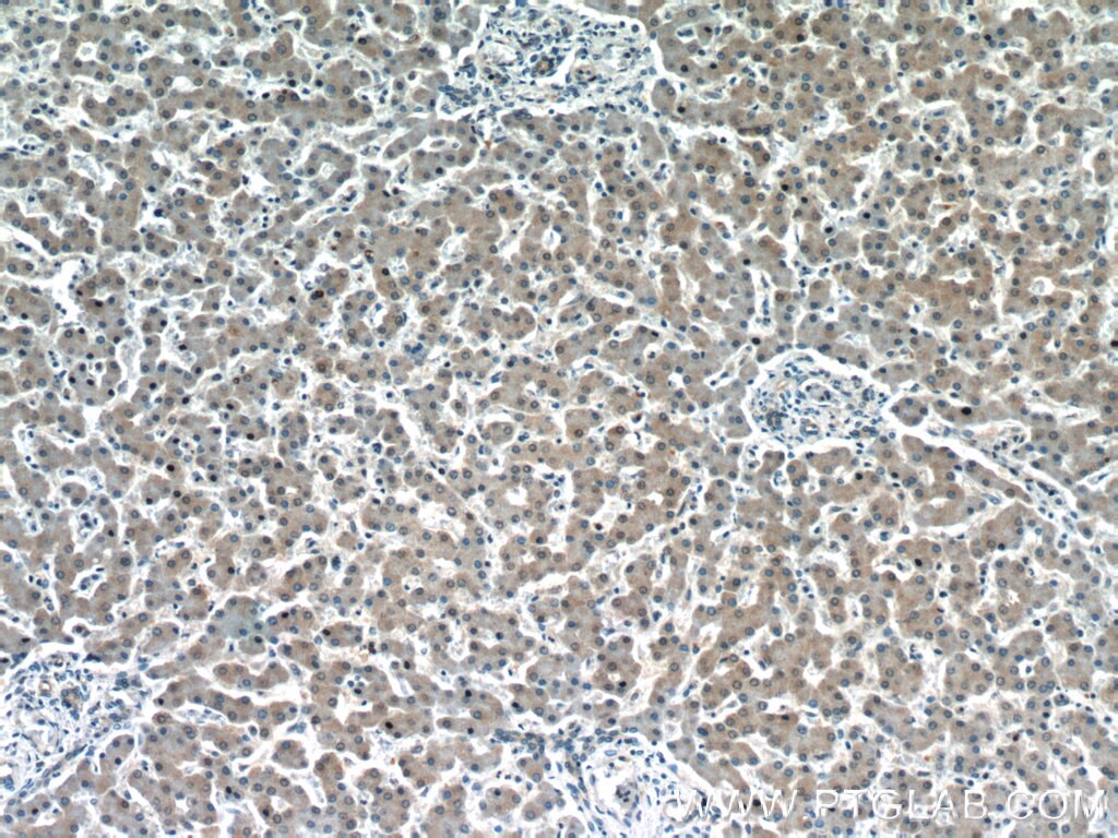 IHC staining of human liver using 22399-1-AP