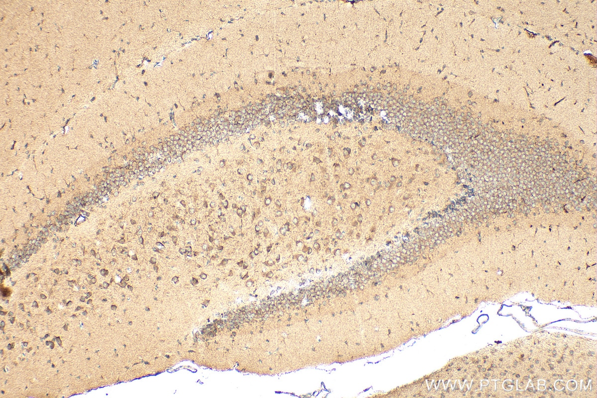 Immunohistochemistry (IHC) staining of mouse brain tissue using Syntenin-1 Polyclonal antibody (22399-1-AP)