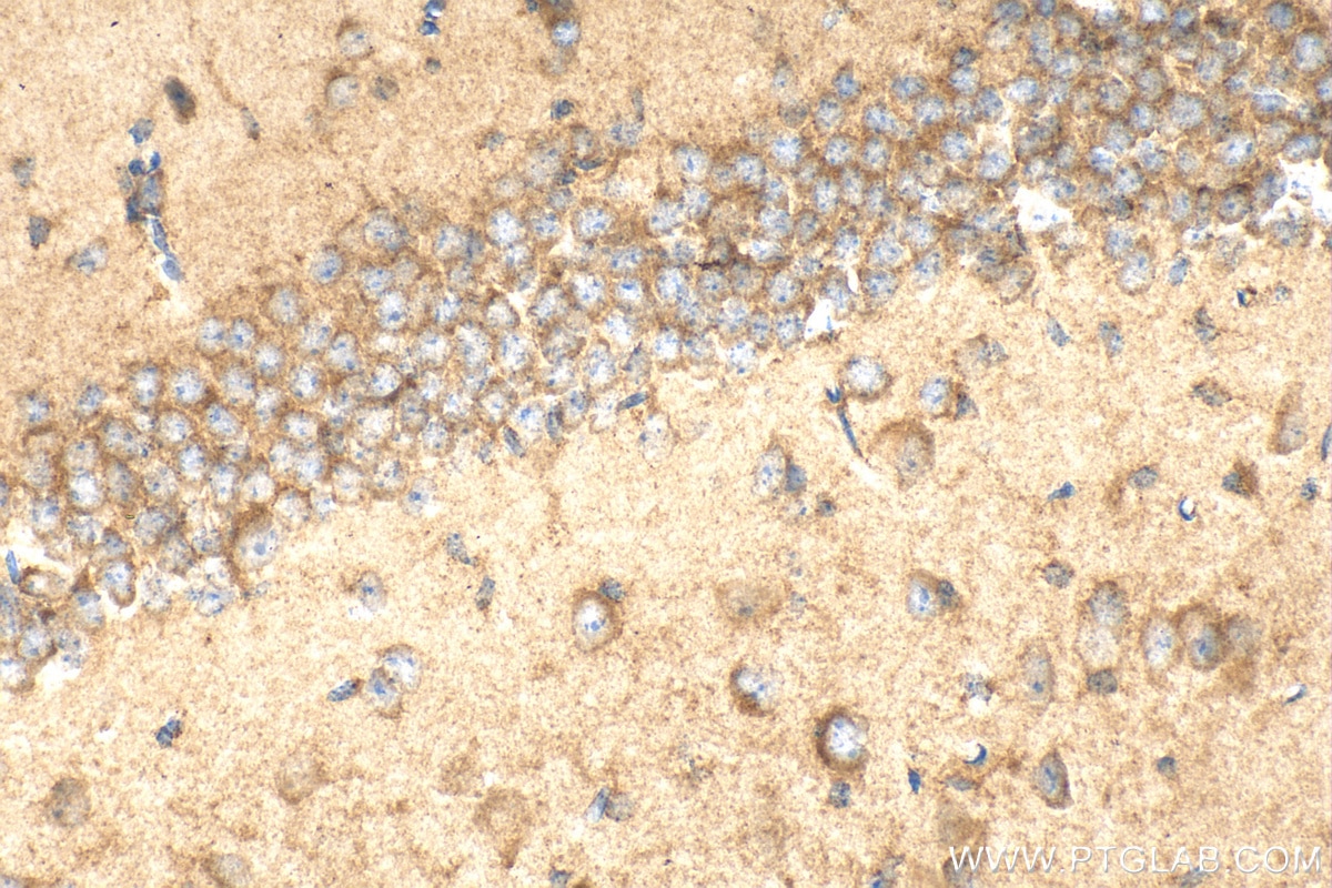 Immunohistochemistry (IHC) staining of mouse brain tissue using Syntenin-1 Polyclonal antibody (22399-1-AP)
