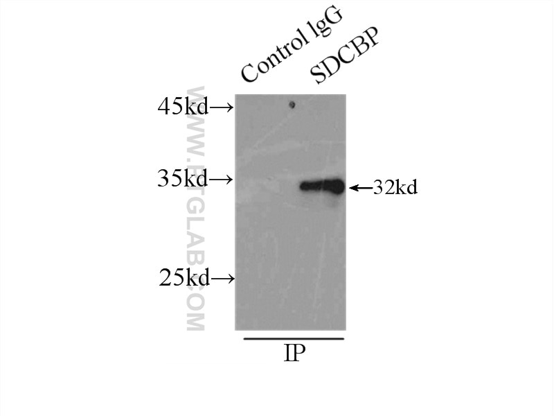 Immunoprecipitation (IP) experiment of HeLa cells using Syntenin-1 Polyclonal antibody (22399-1-AP)