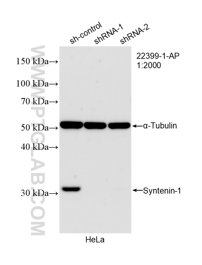 Western Blot (WB) analysis of HeLa cells using Syntenin-1 Polyclonal antibody (22399-1-AP)