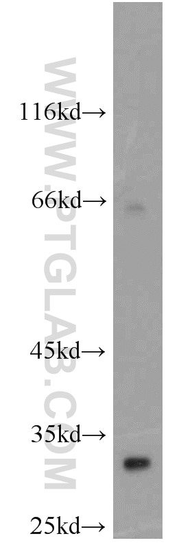 Western Blot (WB) analysis of human placenta tissue using Syntenin-1 Polyclonal antibody (22399-1-AP)