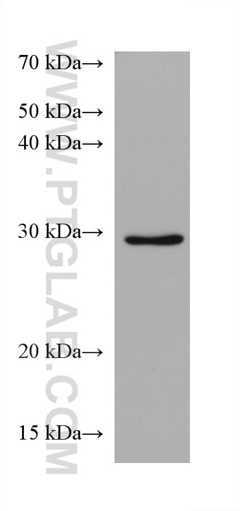 Western Blot (WB) analysis of U2OS cells using Syntenin-1 Monoclonal antibody (68096-1-Ig)
