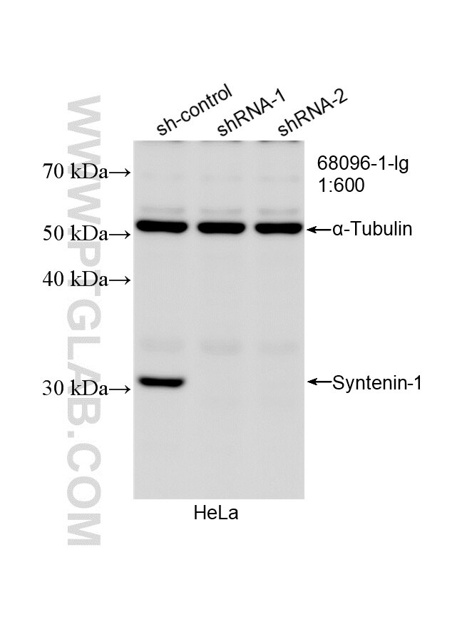 Western Blot (WB) analysis of HeLa cells using Syntenin-1 Monoclonal antibody (68096-1-Ig)