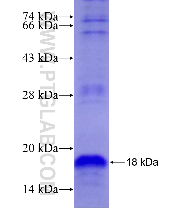 SDCBP fusion protein Ag18078 SDS-PAGE