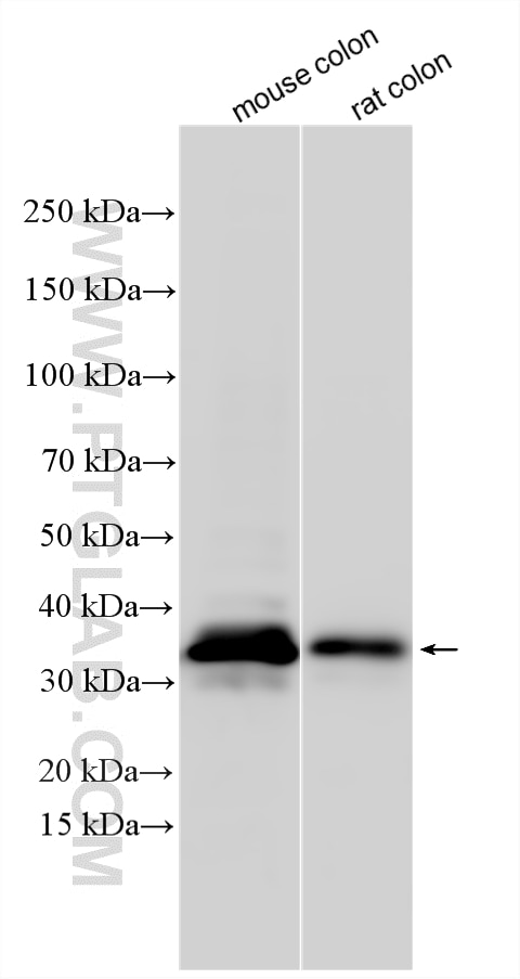 Various lysates were subjected to SDS PAGE followed by western blot with 10407-1-AP (Syntenin 2 antibody) at dilution of 1:2000 incubated at room temperature for 1.5 hours. Western Blot (WB) analysis of various lysates using Syntenin 2 Polyclonal antibody (10407-1-AP)