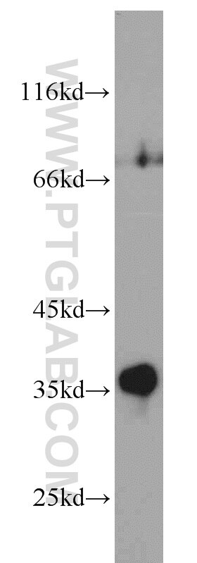 Western Blot (WB) analysis of human liver tissue using Syntenin 2 Polyclonal antibody (10407-1-AP)