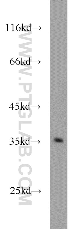 Western Blot (WB) analysis of mouse brain tissue using Syntenin 2 Polyclonal antibody (10407-1-AP)