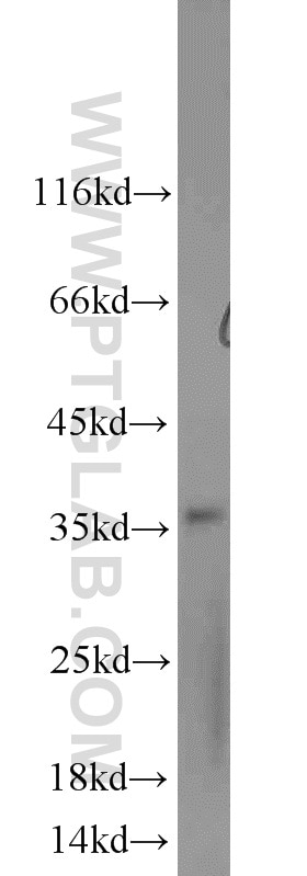 Western Blot (WB) analysis of mouse heart tissue using Syntenin 2 Polyclonal antibody (10407-1-AP)