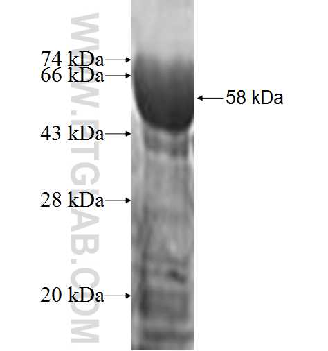 SDCBP2 fusion protein Ag0668 SDS-PAGE