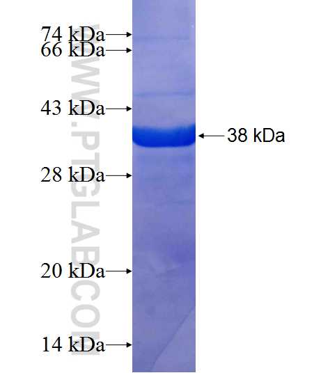 SDCBP2 fusion protein Ag20357 SDS-PAGE