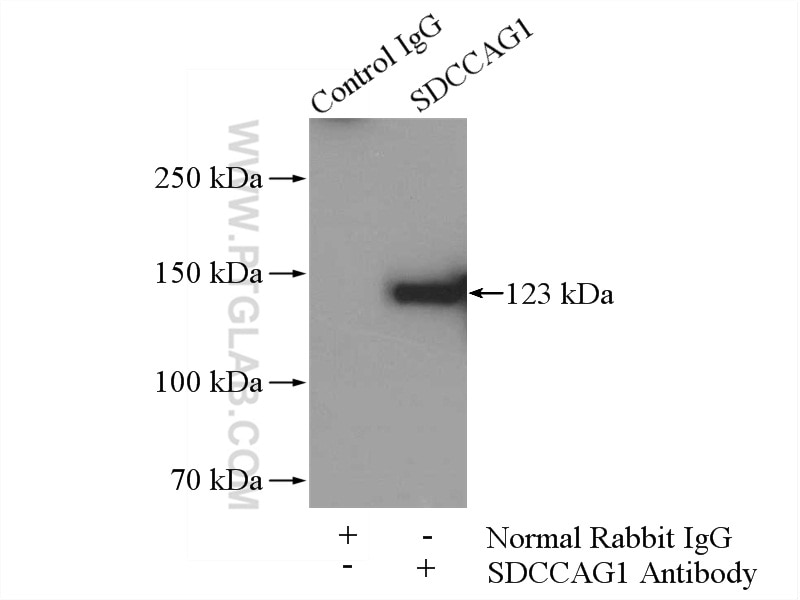 Immunoprecipitation (IP) experiment of A549 cells using SDCCAG1 Polyclonal antibody (11840-1-AP)