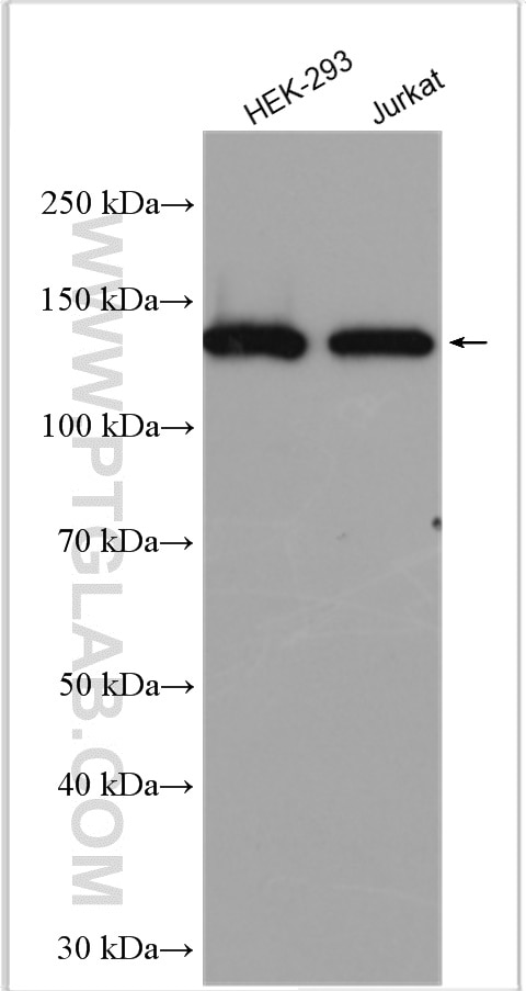 Western Blot (WB) analysis of various lysates using SDCCAG1 Polyclonal antibody (11840-1-AP)
