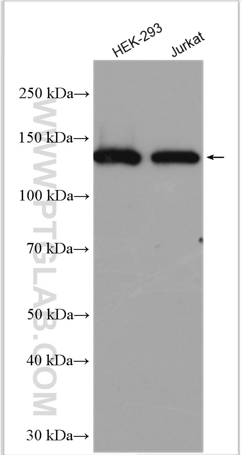 WB analysis using 11840-1-AP