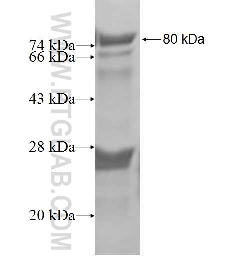 SDCCAG1 fusion protein Ag2467 SDS-PAGE