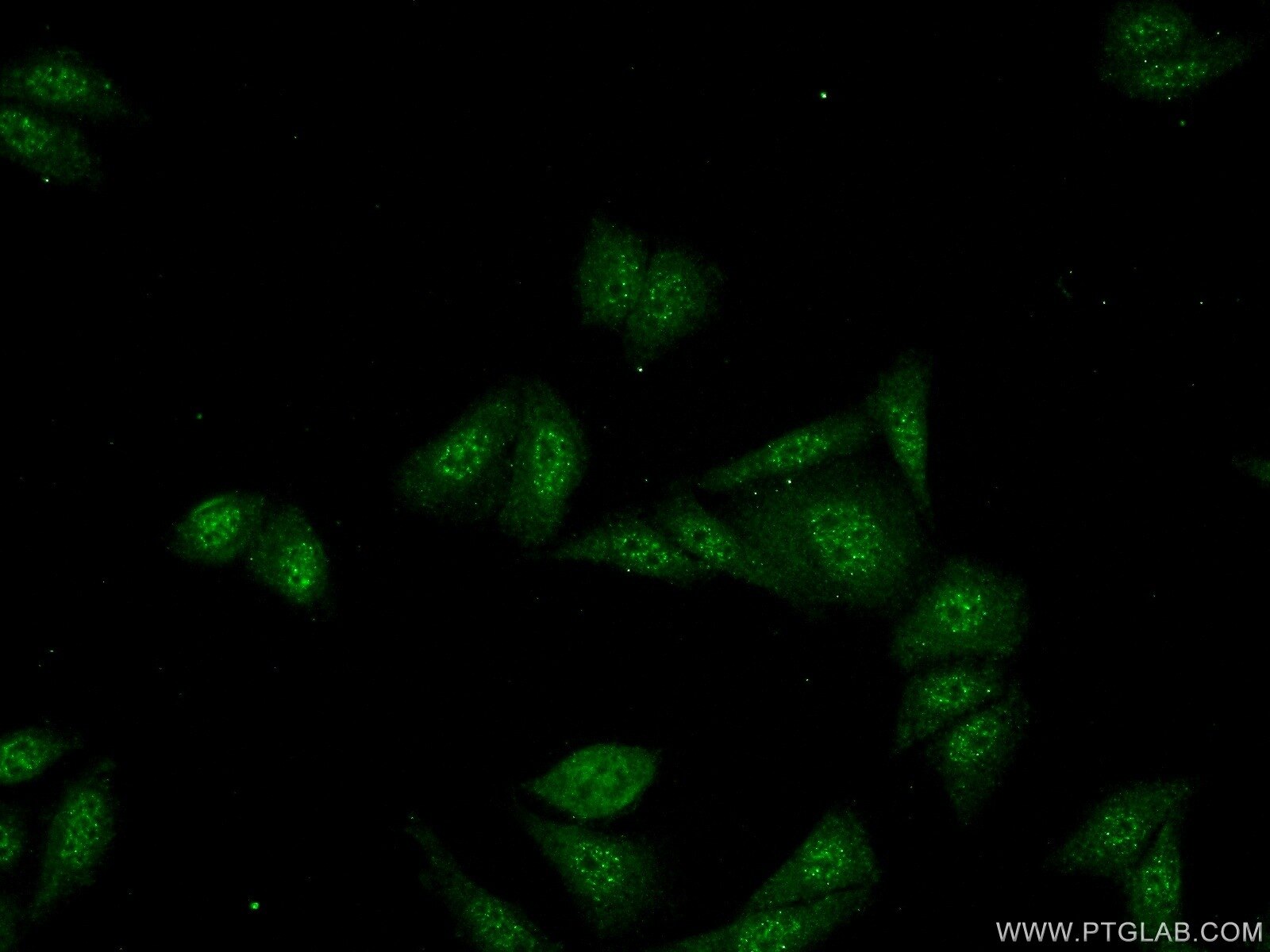Immunofluorescence (IF) / fluorescent staining of HepG2 cells using SDCCAG10 Polyclonal antibody (16502-1-AP)