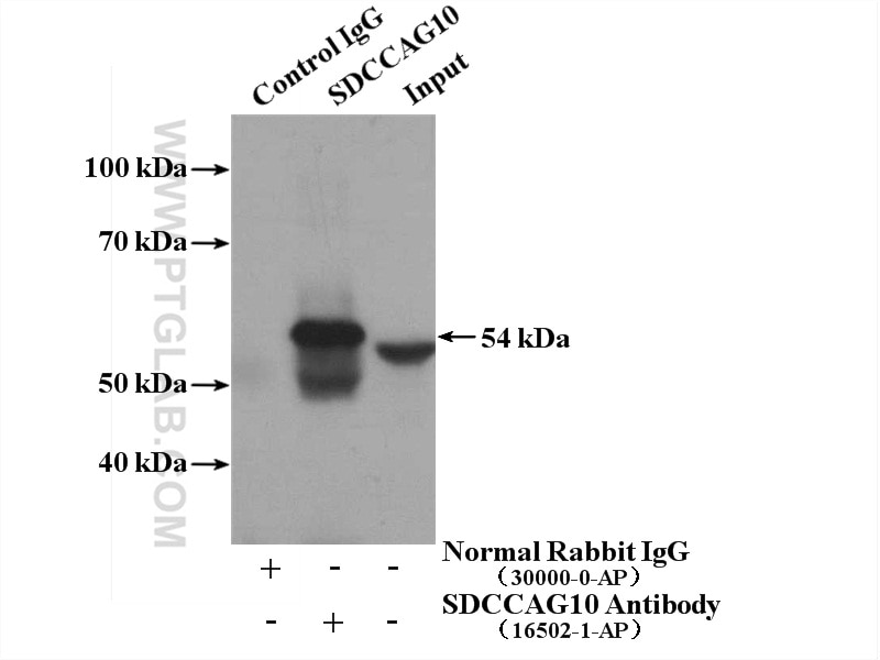 Immunoprecipitation (IP) experiment of HepG2 cells using SDCCAG10 Polyclonal antibody (16502-1-AP)