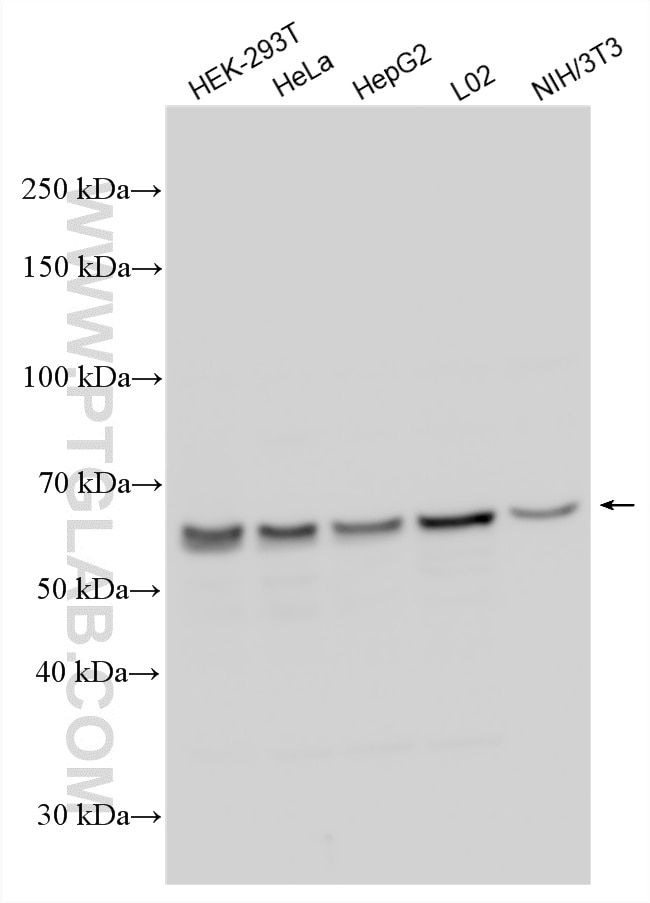 Western Blot (WB) analysis of various lysates using SDCCAG10 Polyclonal antibody (16502-1-AP)